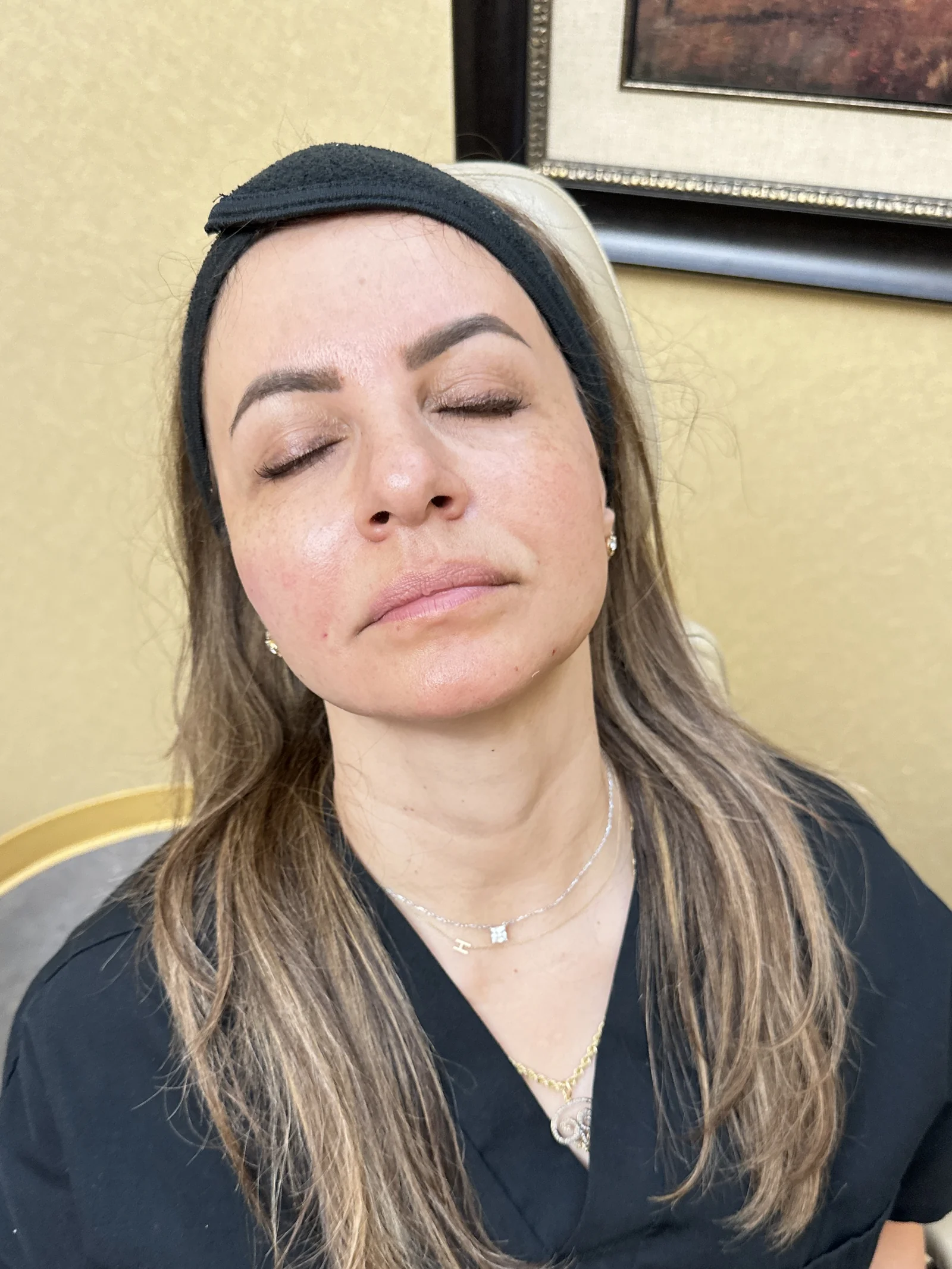 Relaxed, refreshed skin after aesthetic treatment at Reviv Med Spa, Millbrae